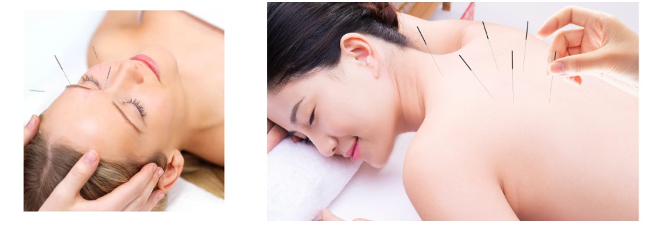 cosmetic_accu_001 cosmetic_accu_001